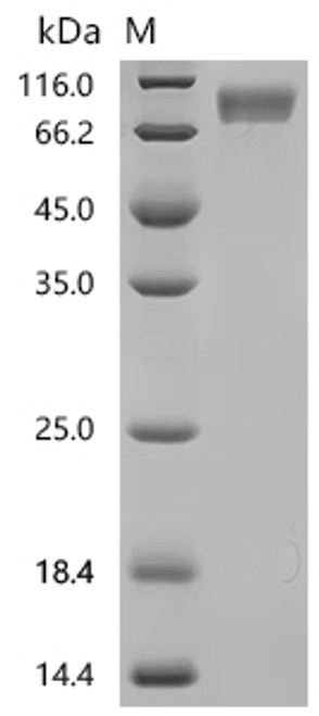 Recombinant Macaca fascicularis CD226 antigen (CD226), partial, Biotinylated (CSB-MP6842MOV-B)