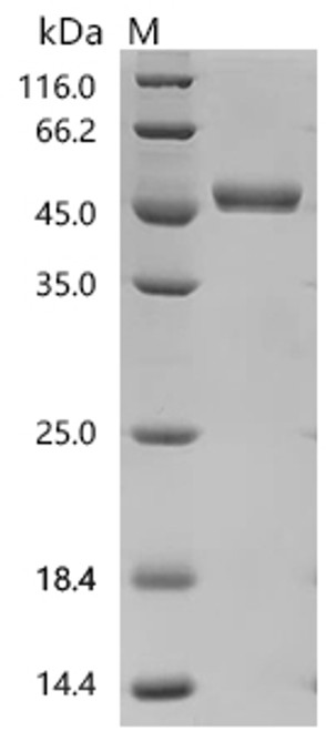 Recombinant Rat Interleukin-2 (Il2) (CSB-MP011629RAd9) Recombinant Rat Interleukin-2 (Il2) (CSB-MP011629RAd9)