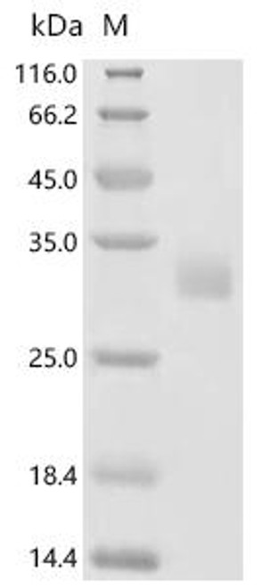 Recombinant Human Neuronal acetylcholine receptor subunit alpha-9 (CHRNA9), partial (CSB-YP887022HUi4)