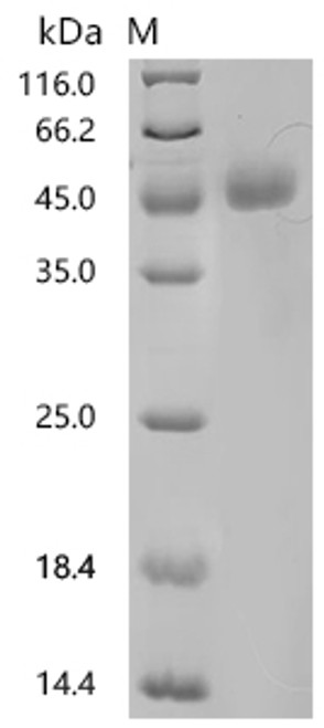 Recombinant Human Neuronal acetylcholine receptor subunit alpha-9 (CHRNA9), partial (CSB-YP887022HUa4) Recombinant Human Neuronal acetylcholine receptor subunit alpha-9 (CHRNA9), partial (CSB-YP887022HUa4)