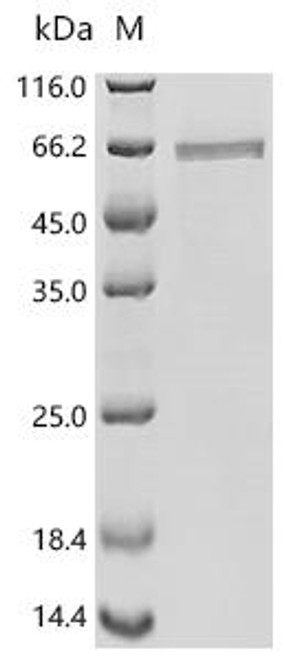 Recombinant Influenza A virus Nucleoprotein (NP) (CSB-BP395556ILQ) Recombinant Influenza A virus Nucleoprotein (NP) (CSB-BP395556ILQ)