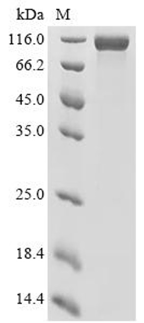 Recombinant Human Epidermal growth factor receptor (EGFR), partial (CSB-MP007479HUr8) Recombinant Human Epidermal growth factor receptor (EGFR), partial (CSB-MP007479HUr8)