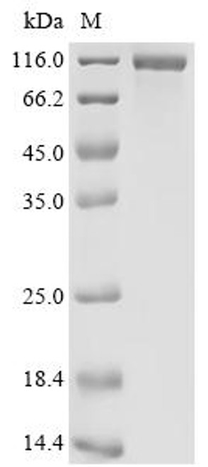 Recombinant Human Epidermal growth factor receptor (EGFR), partial (CSB-MP007479HUr4)