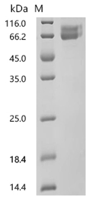 Recombinant Macaca mulatta Transforming growth factor beta (TGFB1) (C33S) (CSB-MP6752MOW(A4)(M)) Recombinant Macaca mulatta Transforming growth factor beta (TGFB1) (C33S) (CSB-MP6752MOW(A4)(M))