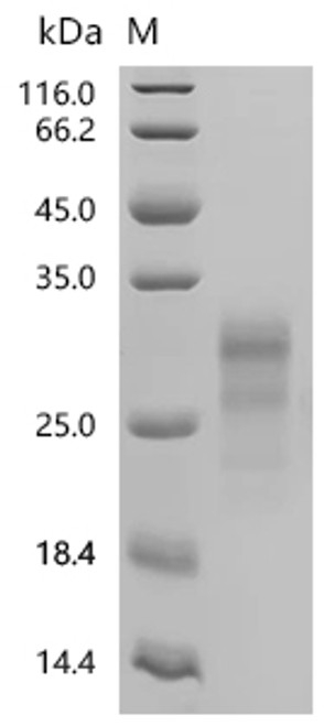 Recombinant Macaca mulatta Interferon gamma (IFNG), Biotinylated (CSB-MP011050MOWk7-B) Recombinant Macaca mulatta Interferon gamma (IFNG), Biotinylated (CSB-MP011050MOWk7-B)