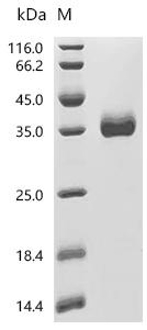 Recombinant Human Coagulation factor XI (F11) (C500S), partial (CSB-MP007916HU2(M)) Recombinant Human Coagulation factor XI (F11) (C500S), partial (CSB-MP007916HU2(M))