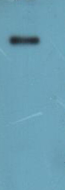 Recombinant Human Leucine-rich repeat-containing G-protein coupled receptor 5 (LGR5)-VLPs (Active) (CSB-MP012906HU(A4)) Recombinant Human Leucine-rich repeat-containing G-protein coupled receptor 5 (LGR5)-VLPs (Active) (CSB-MP012906HU(A4))