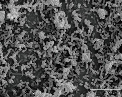 Electron microscope image of bacteria