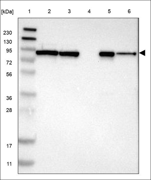 Lane 1: Marker [kDa] 230,130,95,72,56,36,28,17,11 Lane 2: RT4 Lane 3: U-251 MG Lane 4: Human Plasma Lane 5: Liver Lane 6: Tonsil