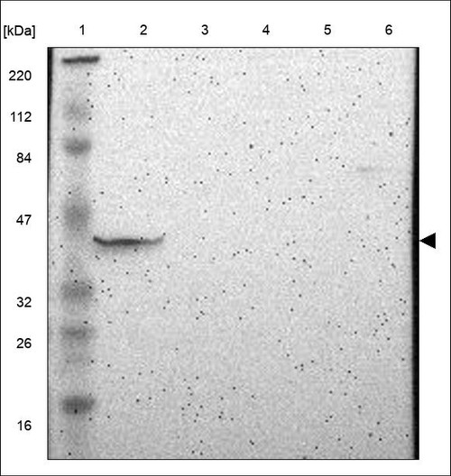 Lane 1: Marker [kDa] 220,112,84,47,32,26,16.8 Lane 2: RT4 Lane 3: U-251 MG Lane 4: Human Plasma Lane 5: Liver Lane 6: Tonsil