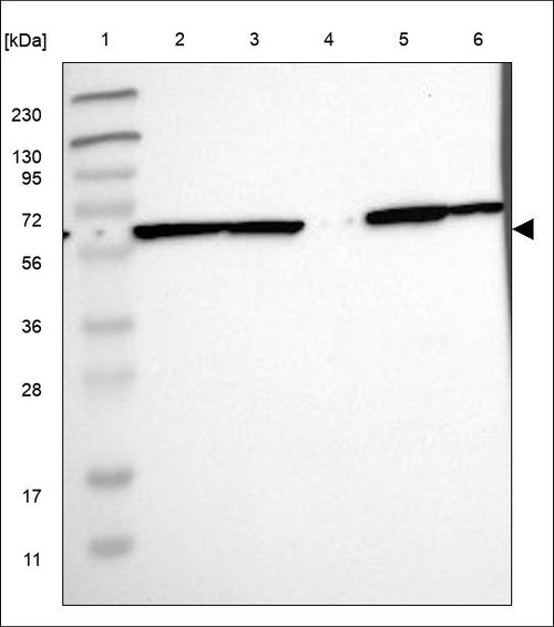 Lane 1: Marker [kDa] 230,130,95,72,56,36,28,17,11 Lane 2: RT4 Lane 3: U-251 MG Lane 4: Human Plasma Lane 5: Liver Lane 6: Tonsil