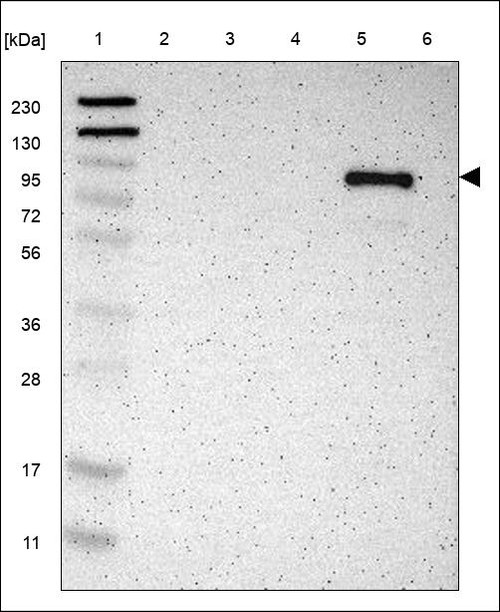 Lane 1: Marker [kDa] 230,130,95,72,56,36,28,17,11 Lane 2: RT4 Lane 3: U-251 MG Lane 4: Human Plasma Lane 5: Liver Lane 6: Tonsil