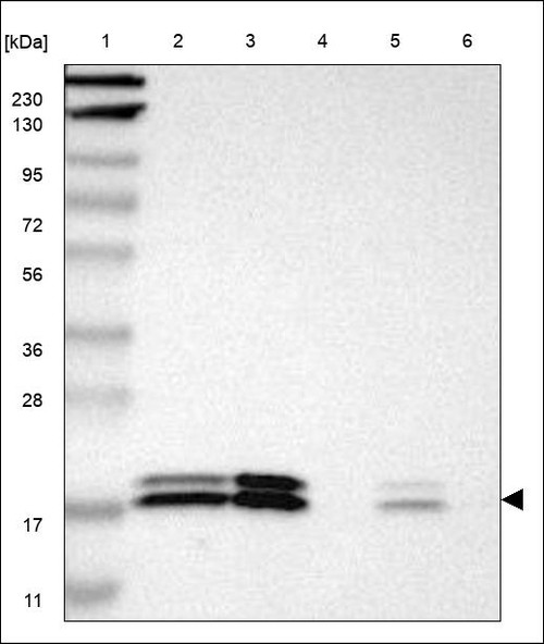 Lane 1: Marker [kDa] 230,130,95,72,56,36,28,17,11 Lane 2: RT4 Lane 3: U-251 MG Lane 4: Human Plasma Lane 5: Liver Lane 6: Tonsil