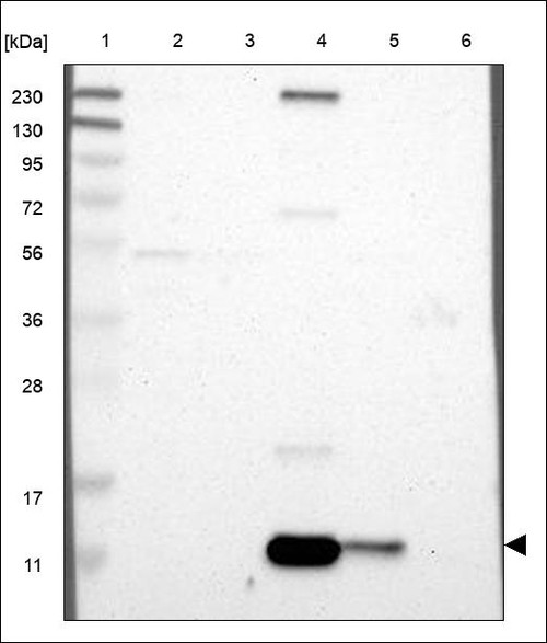 Lane 1: Marker [kDa] 230,130,95,72,56,36,28,17,11 Lane 2: RT4 Lane 3: U-251 MG Lane 4: Human Plasma Lane 5: Liver Lane 6: Tonsil