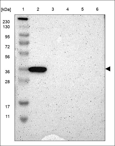 Lane 1: Marker [kDa] 230,130,95,72,56,36,28,17,11 Lane 2: RT4 Lane 3: U-251 MG Lane 4: Human Plasma Lane 5: Liver Lane 6: Tonsil