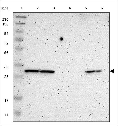 Lane 1: Marker [kDa] 230,130,95,72,56,36,28,17,11 Lane 2: RT4 Lane 3: U-251 MG Lane 4: Human Plasma Lane 5: Liver Lane 6: Tonsil
