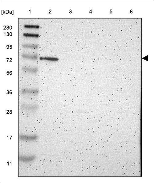 Lane 1: Marker [kDa] 230,130,95,72,56,36,28,17,11 Lane 2: RT4 Lane 3: U-251 MG Lane 4: Human Plasma Lane 5: Liver Lane 6: Tonsil