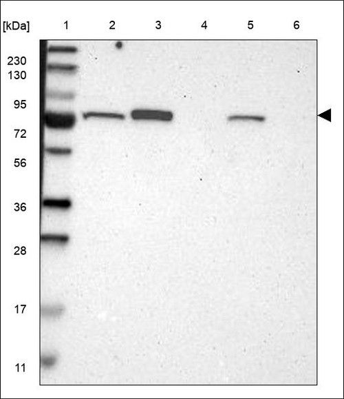 Lane 1: Marker [kDa] 230,130,95,72,56,36,28,17,11 Lane 2: RT4 Lane 3: U-251 MG Lane 4: Human Plasma Lane 5: Liver Lane 6: Tonsil