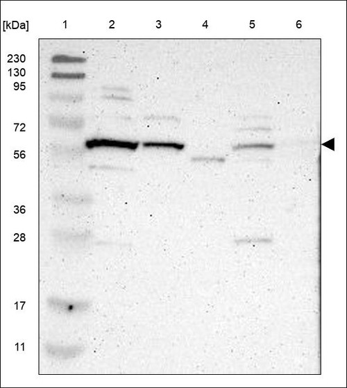 Lane 1: Marker [kDa] 230,130,95,72,56,36,28,17,11 Lane 2: RT4 Lane 3: U-251 MG Lane 4: Human Plasma Lane 5: Liver Lane 6: Tonsil