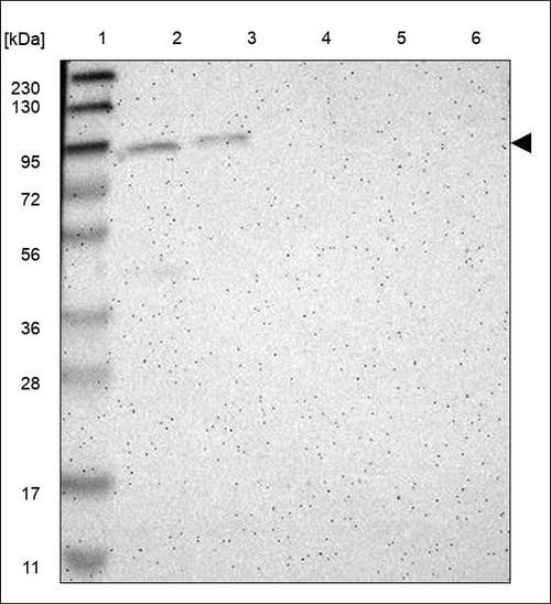 Lane 1: Marker [kDa] 230,130,95,72,56,36,28,17,11 Lane 2: RT4 Lane 3: U-251 MG Lane 4: Human Plasma Lane 5: Liver Lane 6: Tonsil