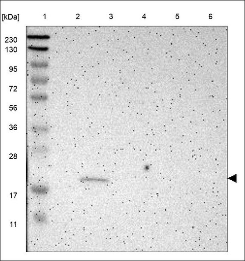Lane 1: Marker [kDa] 230,130,95,72,56,36,28,17,11 Lane 2: RT4 Lane 3: U-251 MG Lane 4: Human Plasma Lane 5: Liver Lane 6: Tonsil
