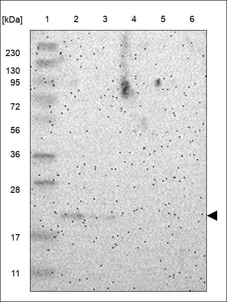 Lane 1: Marker [kDa] 230,130,95,72,56,36,28,17,11 Lane 2: RT4 Lane 3: U-251 MG Lane 4: Human Plasma Lane 5: Liver Lane 6: Tonsil