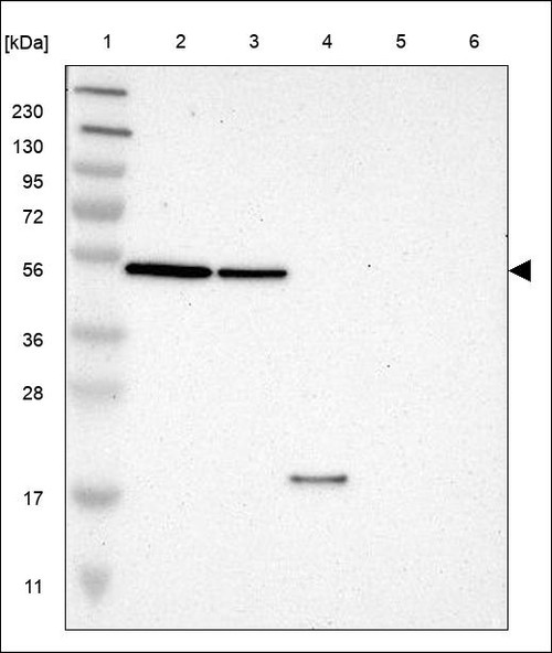 Lane 1: Marker [kDa] 230,130,95,72,56,36,28,17,11 Lane 2: RT4 Lane 3: U-251 MG Lane 4: Human Plasma Lane 5: Liver Lane 6: Tonsil