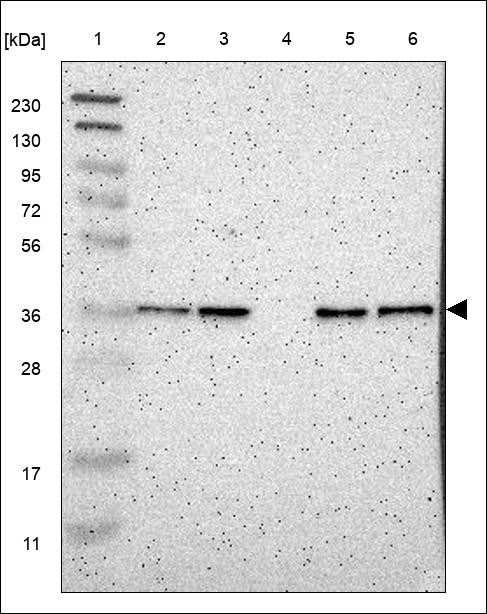 Lane 1: Marker [kDa] 230,130,95,72,56,36,28,17,11 Lane 2: RT4 Lane 3: U-251 MG Lane 4: Human Plasma Lane 5: Liver Lane 6: Tonsil