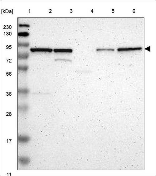 Lane 1: Marker [kDa] 230,130,95,72,56,36,28,17,11 Lane 2: RT4 Lane 3: U-251 MG Lane 4: Human Plasma Lane 5: Liver Lane 6: Tonsil