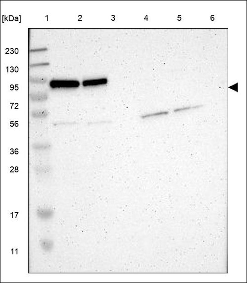 Lane 1: Marker [kDa] 230,130,95,72,56,36,28,17,11 Lane 2: RT4 Lane 3: U-251 MG Lane 4: Human Plasma Lane 5: Liver Lane 6: Tonsil