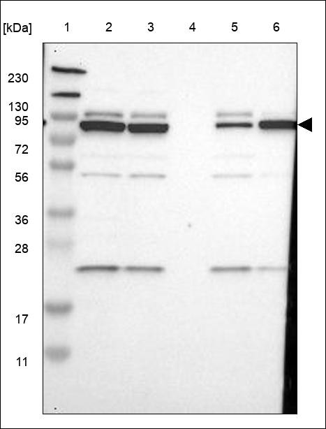 Lane 1: Marker [kDa] 230,130,95,72,56,36,28,17,11 Lane 2: RT4 Lane 3: U-251 MG Lane 4: Human Plasma Lane 5: Liver Lane 6: Tonsil