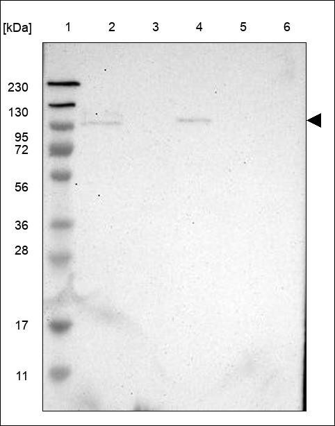 Lane 1: Marker [kDa] 230,130,95,72,56,36,28,17,11 Lane 2: RT4 Lane 3: U-251 MG Lane 4: Human Plasma Lane 5: Liver Lane 6: Tonsil