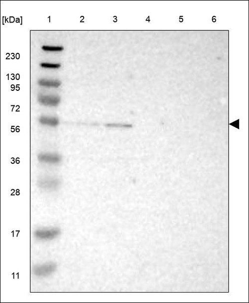 Lane 1: Marker [kDa] 230,130,95,72,56,36,28,17,11 Lane 2: RT4 Lane 3: U-251 MG Lane 4: Human Plasma Lane 5: Liver Lane 6: Tonsil