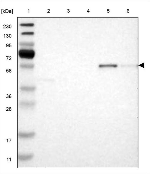 Lane 1: Marker [kDa] 230,130,95,72,56,36,28,17,11 Lane 2: RT4 Lane 3: U-251 MG Lane 4: Human Plasma Lane 5: Liver Lane 6: Tonsil