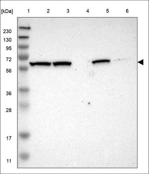 Lane 1: Marker [kDa] 230,130,95,72,56,36,28,17,11 Lane 2: RT4 Lane 3: U-251 MG Lane 4: Human Plasma Lane 5: Liver Lane 6: Tonsil