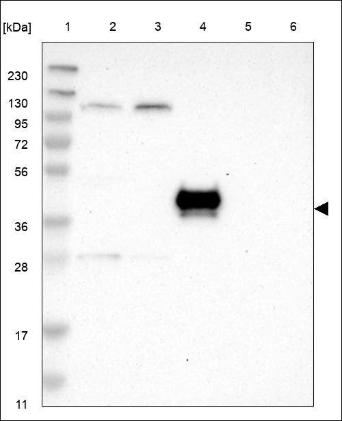 Lane 1: Marker [kDa] 230,130,95,72,56,36,28,17,11 Lane 2: RT4 Lane 3: U-251 MG Lane 4: Human Plasma Lane 5: Liver Lane 6: Tonsil