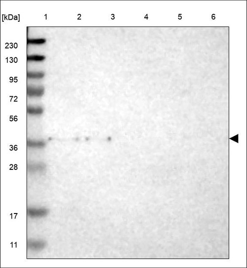 Lane 1: Marker [kDa] 230,130,95,72,56,36,28,17,11 Lane 2: RT4 Lane 3: U-251 MG Lane 4: Human Plasma Lane 5: Liver Lane 6: Tonsil