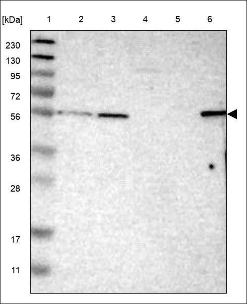 Lane 1: Marker [kDa] 230,130,95,72,56,36,28,17,11 Lane 2: RT4 Lane 3: U-251 MG Lane 4: Human Plasma Lane 5: Liver Lane 6: Tonsil