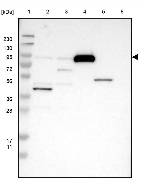 Lane 1: Marker [kDa] 230,130,95,72,56,36,28,17,11 Lane 2: RT4 Lane 3: U-251 MG Lane 4: Human Plasma Lane 5: Liver Lane 6: Tonsil