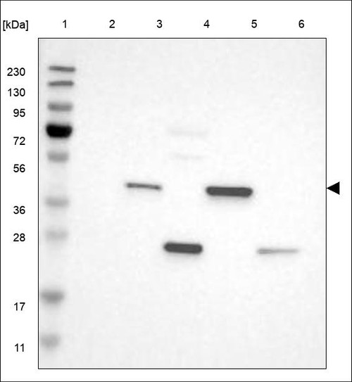 Lane 1: Marker [kDa] 230,130,95,72,56,36,28,17,11 Lane 2: RT4 Lane 3: U-251 MG Lane 4: Human Plasma Lane 5: Liver Lane 6: Tonsil
