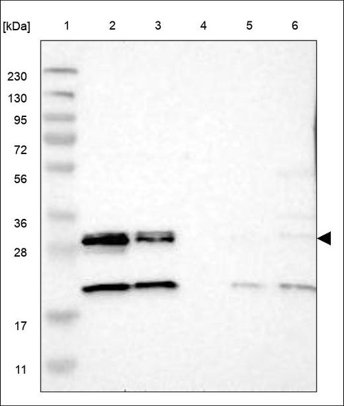 Lane 1: Marker [kDa] 230,130,95,72,56,36,28,17,11 Lane 2: RT4 Lane 3: U-251 MG Lane 4: Human Plasma Lane 5: Liver Lane 6: Tonsil