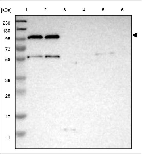 Lane 1: Marker [kDa] 230,130,95,72,56,36,28,17,11 Lane 2: RT4 Lane 3: U-251 MG Lane 4: Human Plasma Lane 5: Liver Lane 6: Tonsil