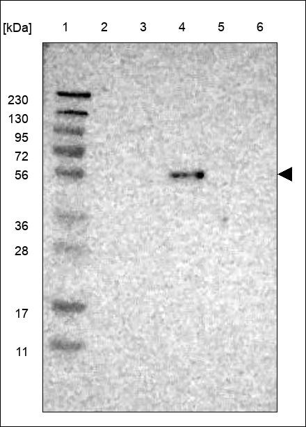 Lane 1: Marker [kDa] 230,130,95,72,56,36,28,17,11 Lane 2: RT4 Lane 3: U-251 MG Lane 4: Human Plasma Lane 5: Liver Lane 6: Tonsil