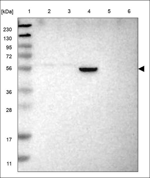 Lane 1: Marker [kDa] 230,130,95,72,56,36,28,17,11 Lane 2: RT4 Lane 3: U-251 MG Lane 4: Human Plasma Lane 5: Liver Lane 6: Tonsil