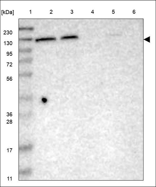 Lane 1: Marker [kDa] 230,130,95,72,56,36,28,17,11 Lane 2: RT4 Lane 3: U-251 MG Lane 4: Human Plasma Lane 5: Liver Lane 6: Tonsil