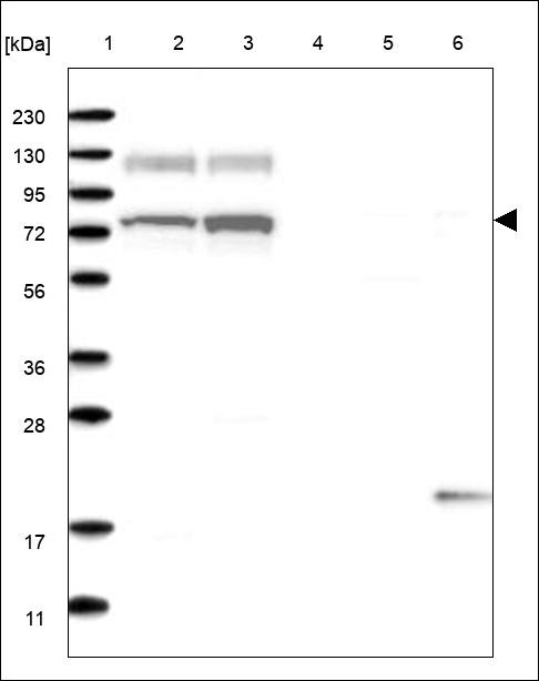 Lane 1: Marker [kDa] 230,130,95,72,56,36,28,17,11 Lane 2: RT4 Lane 3: U-251 MG Lane 4: Human Plasma Lane 5: Liver Lane 6: Tonsil