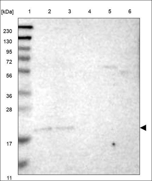 Lane 1: Marker [kDa] 230,130,95,72,56,36,28,17,11 Lane 2: RT4 Lane 3: U-251 MG Lane 4: Human Plasma Lane 5: Liver Lane 6: Tonsil