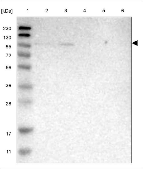 Lane 1: Marker [kDa] 230,130,95,72,56,36,28,17,11 Lane 2: RT4 Lane 3: U-251 MG Lane 4: Human Plasma Lane 5: Liver Lane 6: Tonsil