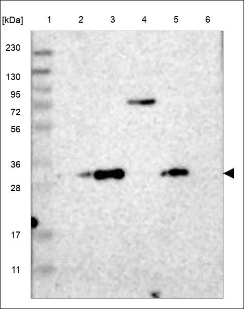 Lane 1: Marker [kDa] 230,130,95,72,56,36,28,17,11 Lane 2: RT4 Lane 3: U-251 MG Lane 4: Human Plasma Lane 5: Liver Lane 6: Tonsil