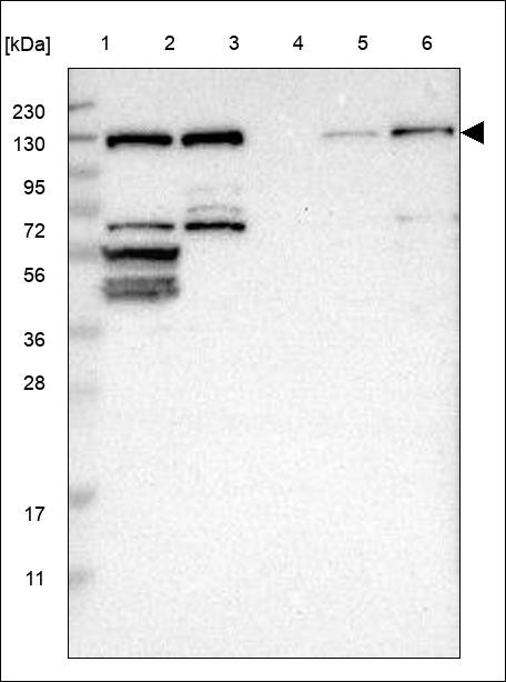 Lane 1: Marker [kDa] 230,130,95,72,56,36,28,17,11 Lane 2: RT4 Lane 3: U-251 MG Lane 4: Human Plasma Lane 5: Liver Lane 6: Tonsil